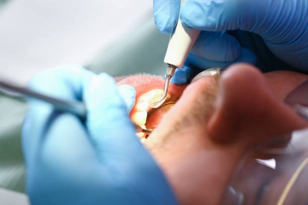Best Weekend Emergency Dentist in Combes, TX