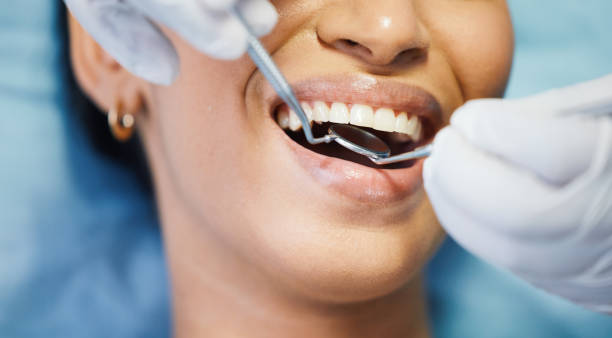 Best Emergency Root Canal Treatment in Combes, TX