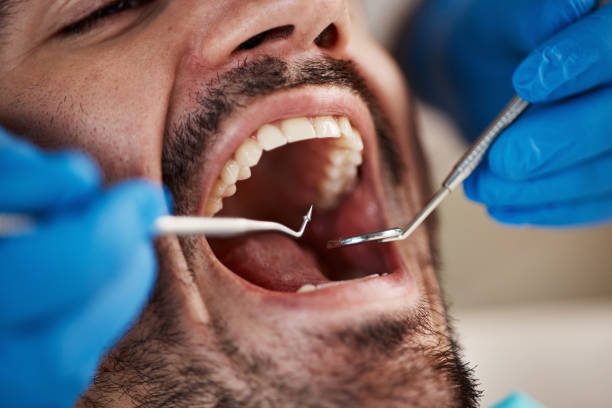 Best Cosmetic Emergency Dentistry in Combes, TX