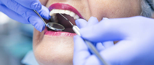 Best Emergency Dental Care for Broken or Chipped Teeth in Combes, TX